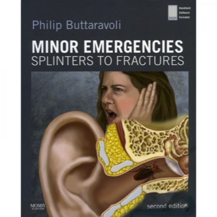Book Review: Minor Emergencies by Philip M. Buttaravoli