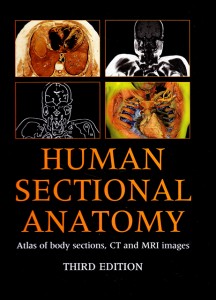 Book Review: Human Sectional Anatomy (2009) by Professor Harold Ellis