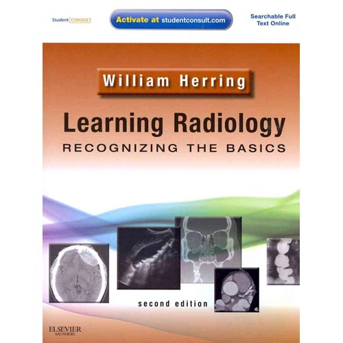 Learning Radiology Recognizing the Basics
