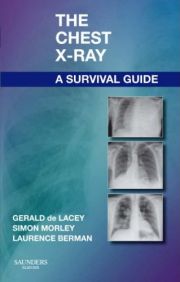 Book Review: The Chest X-Ray: A Survival Guide