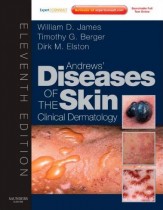 Andrews Diseases of the Skin Clinical Dermatology 11th