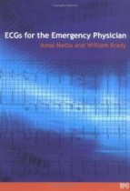 ecgs for emergency physician 1