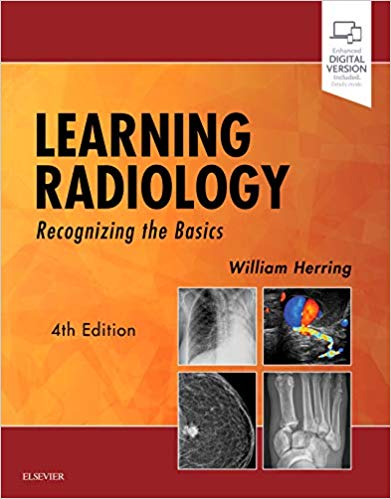 Learning Radiology (2019)