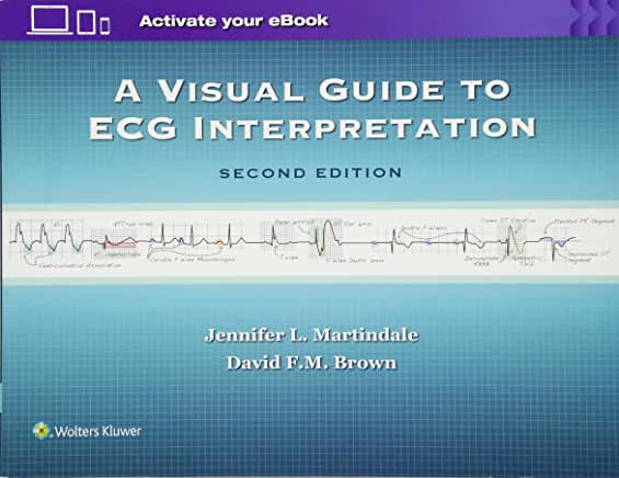 A Visual Guide to ECG Interpretation (2017)